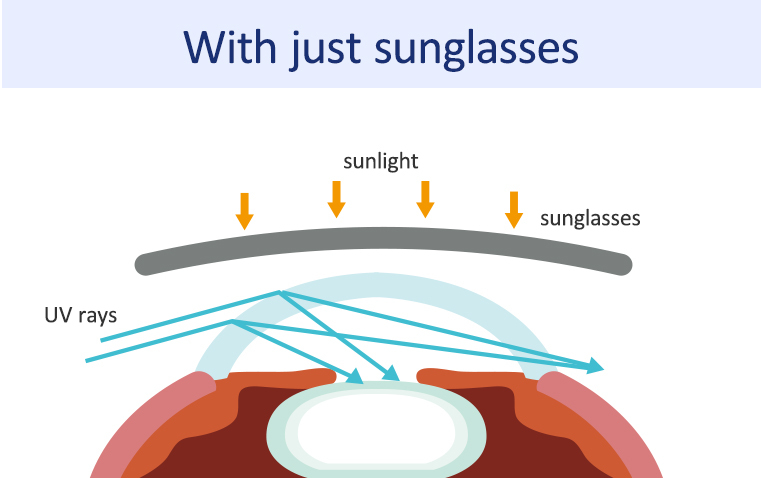 Infographic showing UV rays entering through gaps between sunglasses and the face can still reach the eyes.