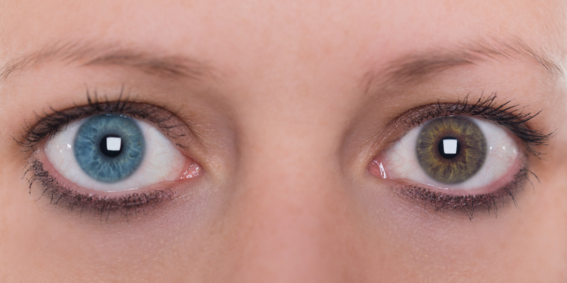 Big close up of womans eye with blue left eye and brown right eye