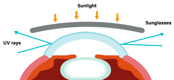 a diagram of what happens to UV rays when you have both glasses and UV lenses on.